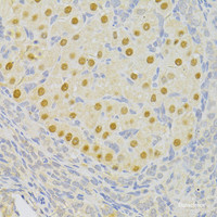 Immunohistochemistry of paraffin-embedded Rat ovary using PFKFB3 Polyclonal Antibody at dilution of 1:100 (40x lens) .