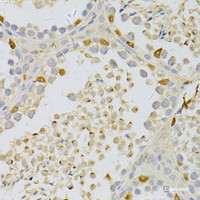 Immunohistochemistry of paraffin-embedded Mouse testis using PFKFB3 Polyclonal Antibody at dilution of 1:100 (40x lens) .