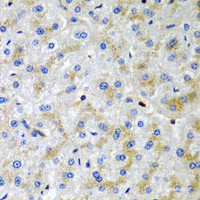 Immunohistochemistry of paraffin-embedded Human liver damage using SRGN Polyclonal Antibody at dilution of 1:200 (40x lens) .