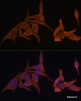 Immunofluorescence analysis of HeLa cells using PRKAB2 Polyclonal Antibody at dilution of 1:100 (40x lens) . Blue: DAPI for nuclear staining.