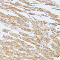 Immunohistochemistry of paraffin-embedded Rat heart using MAP2K5 Polyclonal Antibody at dilution of 1:100 (40x lens) .