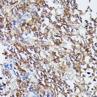 Immunohistochemistry of paraffin-embedded Human appendix using MAP2K5 Polyclonal Antibody at dilution of 1:100 (40x lens) .