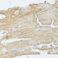 Immunohistochemistry of paraffin-embedded Mouse heart using MAP2K5 Polyclonal Antibody at dilution of 1:100 (40x lens) .