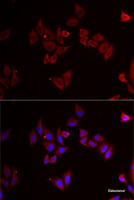 Immunofluorescence analysis of MCF7 cells using MAP2K5 Polyclonal Antibody