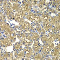 Immunohistochemistry of paraffin-embedded Rat kidney using PSMD5 Polyclonal Antibody at dilution of 1:100 (40x lens) .