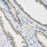 Immunohistochemistry of paraffin-embedded Human prostate using RAD51C Polyclonal Antibody at dilution of 1:100 (40x lens) .