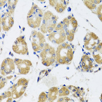 Immunohistochemistry of paraffin-embedded Human stomach using RAD51C Polyclonal Antibody at dilution of 1:100 (40x lens) .