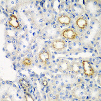 Immunohistochemistry of paraffin-embedded Rat kidney using RARRES2 Polyclonal Antibody at dilution of 1:200 (40x lens) .