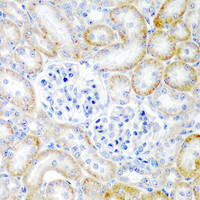 Immunohistochemistry of paraffin-embedded Rat kidney using RLN2 Polyclonal Antibody at dilution of 1:200 (40x lens) .