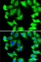 Immunofluorescence analysis of MCF7 cells using RPS5 Polyclonal Antibody