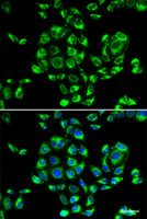 Immunofluorescence analysis of U2OS cells using RPS16 Polyclonal Antibody