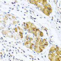 Immunohistochemistry of paraffin-embedded Human stomach using CCL8 Polyclonal Antibody at dilution of 1:100 (40x lens) .