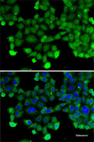 Immunofluorescence analysis of A-549 cells using SNRPD2 Polyclonal Antibody
