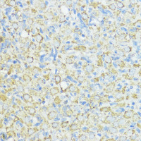 Immunohistochemistry of paraffin-embedded Rat ovary using SOD3 Polyclonal Antibody at dilution of 1:100 (40x lens) .