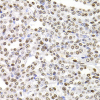 Immunohistochemistry of paraffin-embedded Rat kidney using SOX5 Polyclonal Antibody at dilution of 1:100 (40x lens) .