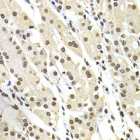 Immunohistochemistry of paraffin-embedded Human stomach using SOX5 Polyclonal Antibody at dilution of 1:100 (40x lens) .