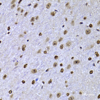 Immunohistochemistry of paraffin-embedded Mouse brain using SOX5 Polyclonal Antibody at dilution of 1:100 (40x lens) .