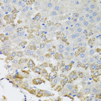 Immunohistochemistry of paraffin-embedded Rat liver using TROVE2 Polyclonal Antibody at dilution of 1:100 (40x lens) .