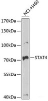 Western blot analysis of extracts of NCI-H460 cells using STAT4 Polyclonal Antibody at dilution of 1:1000.