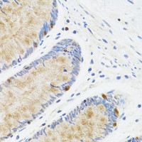 Immunohistochemistry of paraffin-embedded Human rectum using STAT4 Polyclonal Antibody at dilution of 1:100 (40x lens) .