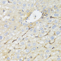 Immunohistochemistry of paraffin-embedded Mouse liver using STAT4 Polyclonal Antibody at dilution of 1:100 (40x lens) .