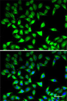 Immunofluorescence analysis of MCF7 cells using STAT4 Polyclonal Antibody