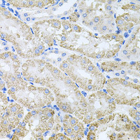 Immunohistochemistry of paraffin-embedded Mouse kidney using TARS Polyclonal Antibody at dilution of 1:100 (40x lens) .