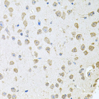 Immunohistochemistry of paraffin-embedded Mouse brain using TARS Polyclonal Antibody at dilution of 1:100 (40x lens) .