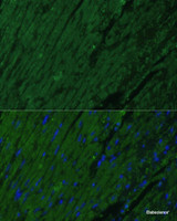 Immunofluorescence analysis of Mouse heart cells using TNNI3 Polyclonal Antibody at dilution of 1:100. Blue: DAPI for nuclear staining.