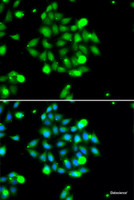 Immunofluorescence analysis of U2OS cells using UBE2G1 Polyclonal Antibody