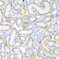 Immunohistochemistry of paraffin-embedded Rat kidney using WRB Polyclonal Antibody at dilution of 1:200 (40x lens) .