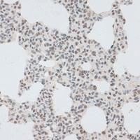 Immunohistochemistry of paraffin-embedded Rat lung using ZNF148 Polyclonal Antibody at dilution of 1:100 (40x lens) .