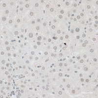 Immunohistochemistry of paraffin-embedded Rat liver using ZNF148 Polyclonal Antibody at dilution of 1:100 (40x lens) .
