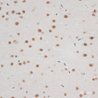 Immunohistochemistry of paraffin-embedded Rat brain using ZNF148 Polyclonal Antibody at dilution of 1:100 (40x lens) .