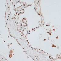 Immunohistochemistry of paraffin-embedded Human lung using ZNF148 Polyclonal Antibody at dilution of 1:100 (40x lens) .