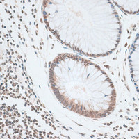 Immunohistochemistry of paraffin-embedded Human colon using ZNF148 Polyclonal Antibody at dilution of 1:100 (40x lens) .