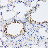 Immunohistochemistry of paraffin-embedded Rat lung using NAA10 Polyclonal Antibody at dilution of 1:100 (40x lens) .