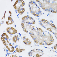 Immunohistochemistry of paraffin-embedded Human stomach using NAA10 Polyclonal Antibody at dilution of 1:100 (40x lens) .