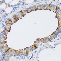 Immunohistochemistry of paraffin-embedded Mouse lung using NAA10 Polyclonal Antibody at dilution of 1:100 (40x lens) .