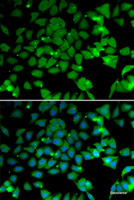 Immunofluorescence analysis of U2OS cells using NAA10 Polyclonal Antibody