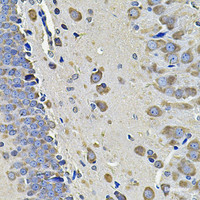 Immunohistochemistry of paraffin-embedded Rat brain using EIF3C Polyclonal Antibody at dilution of 1:100 (40x lens) .