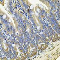 Immunohistochemistry of paraffin-embedded Mouse intestine using EIF3C Polyclonal Antibody at dilution of 1:100 (40x lens) .