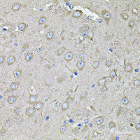 Immunohistochemistry of paraffin-embedded Mouse brain using EIF3C Polyclonal Antibody at dilution of 1:100 (40x lens) .