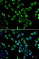 Immunofluorescence analysis of U2OS cells using EIF3C Polyclonal Antibody
