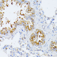 Immunohistochemistry of paraffin-embedded Rat lung using EIF2B2 Polyclonal Antibody at dilution of 1:100 (40x lens) .