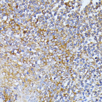 Immunohistochemistry of paraffin-embedded Human tonsil using EIF2B2 Polyclonal Antibody at dilution of 1:100 (40x lens) .
