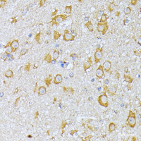 Immunohistochemistry of paraffin-embedded Mouse brain using EIF2B2 Polyclonal Antibody at dilution of 1:100 (40x lens) .