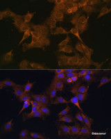 Immunofluorescence analysis of C6 cells using EIF2B2 Polyclonal Antibody at dilution of 1:100. Blue: DAPI for nuclear staining.