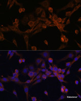 Immunofluorescence analysis of NIH/3T3 cells using EIF2B2 Polyclonal Antibody at dilution of 1:100. Blue: DAPI for nuclear staining.