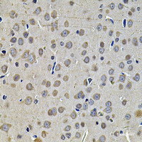 Immunohistochemistry of paraffin-embedded Rat brain using DNAJA3 Polyclonal Antibody at dilution of 1:100 (40x lens) .